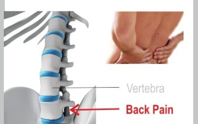 Back Pain Explained